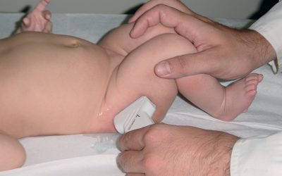 Υπερηχογράφημα ισχίων στα νεογνά. Μια απλή και ανώδυνη εξέταση με μεγάλη σημασία για το μωρό σας